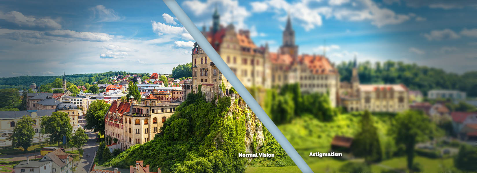 Astigmatism Treatment in Kenner